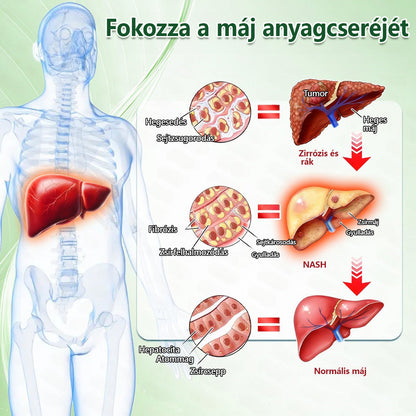 Hivatalos magyar üzlet | 👩‍⚕️🌲 PZGONE® Moringa · Berberin × NAD+ 10 az 1-ben fejlett nano-mikrotűs tapasz 🇭🇺 (Naponta csak egyszer) ✅ Elhízás, megereszkedett bőr, alacsony energiaszint, alvási apnoé, ízületi problémák és egyebek kezelésére