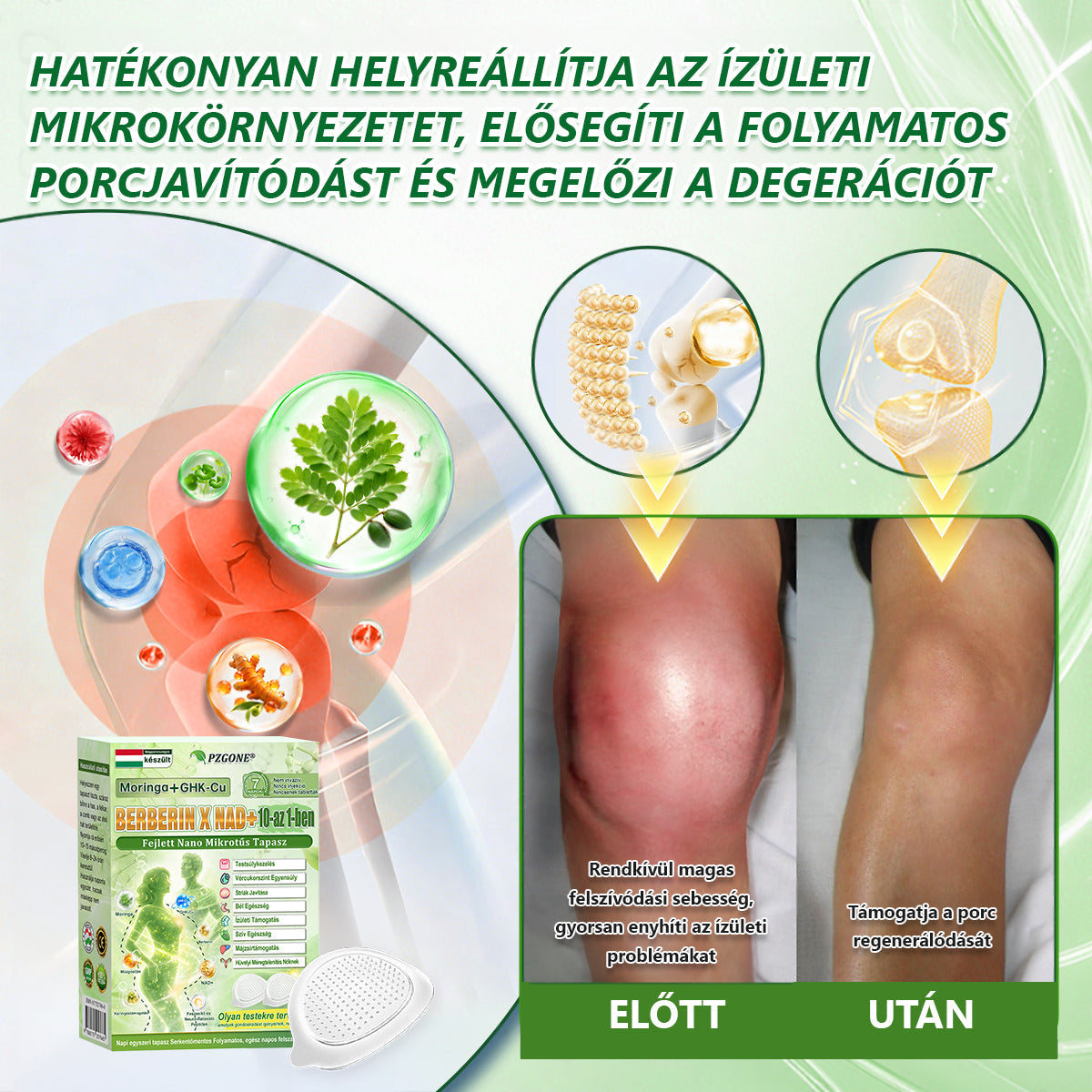 Hivatalos magyar üzlet | 👩‍⚕️🌲 PZGONE® Moringa · Berberin × NAD+ 10 az 1-ben fejlett nano-mikrotűs tapasz 🇭🇺 (Naponta csak egyszer) ✅ Elhízás, megereszkedett bőr, alacsony energiaszint, alvási apnoé, ízületi problémák és egyebek kezelésére
