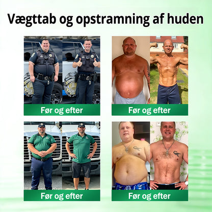 𝑶𝒇𝒇𝒊𝒄𝒊𝒆𝒍 𝑩𝒖𝒕𝒊𝒌 | 🍀🍀 CareUplift® Metabolic Nano Microneedle Patch 🇩🇰 Bruges én gang dagligt | Berberin + Moringa-formel Til dig, der ønsker støtte til vægtkontrol, en lettere hverdag og øget velvære ✅