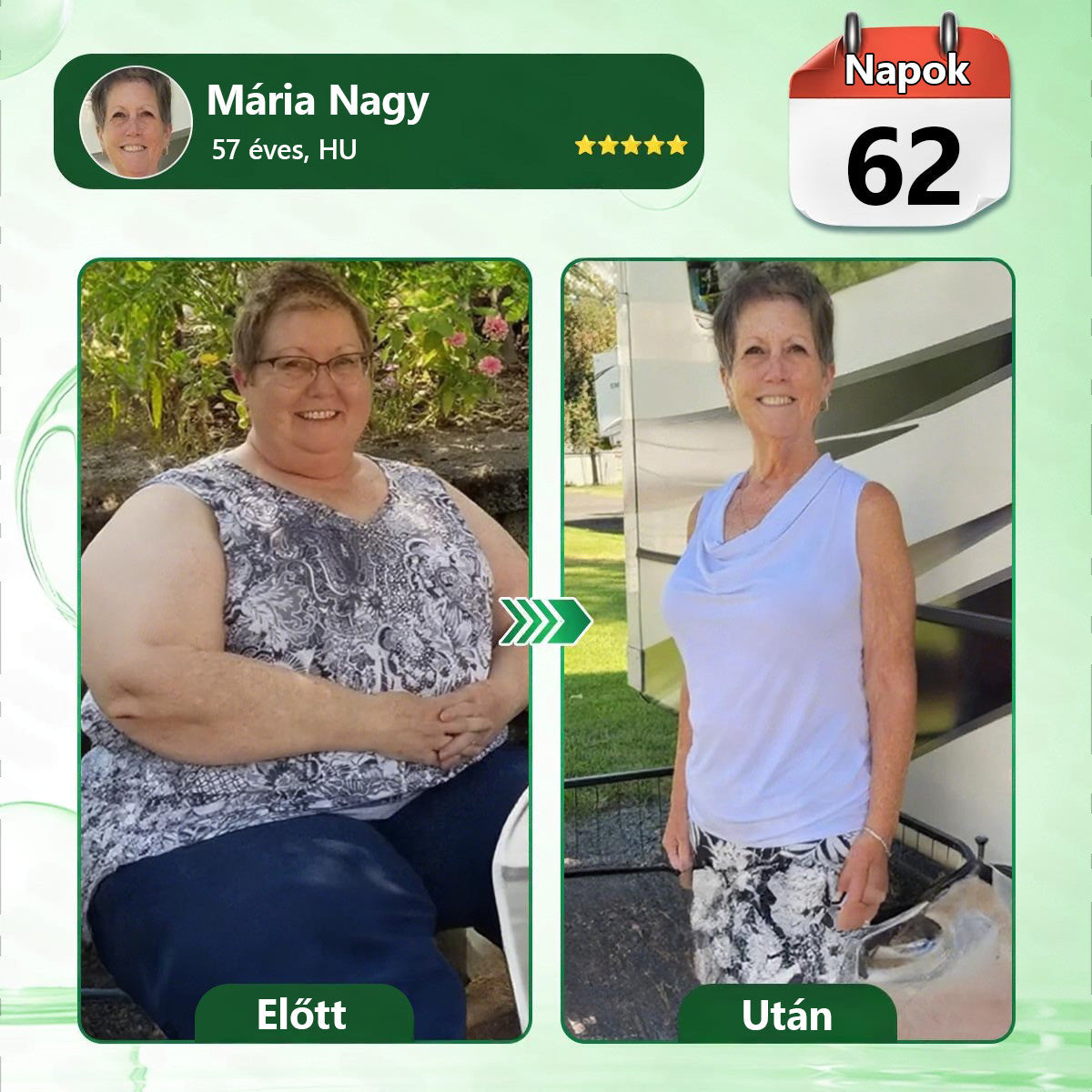 Hivatalos magyar üzlet | 👩‍⚕️🌲 PZGONE® Moringa · Berberin × NAD+ 10 az 1-ben fejlett nano-mikrotűs tapasz 🇭🇺 (Naponta csak egyszer) ✅ Elhízás, megereszkedett bőr, alacsony energiaszint, alvási apnoé, ízületi problémák és egyebek kezelésére
