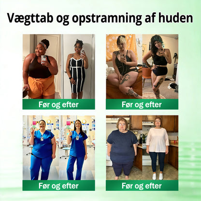 𝑶𝒇𝒇𝒊𝒄𝒊𝒆𝒍 𝑩𝒖𝒕𝒊𝒌 | 🍀🍀 CareUplift® Metabolic Nano Microneedle Patch 🇩🇰 Bruges én gang dagligt | Berberin + Moringa-formel Til dig, der ønsker støtte til vægtkontrol, en lettere hverdag og øget velvære ✅
