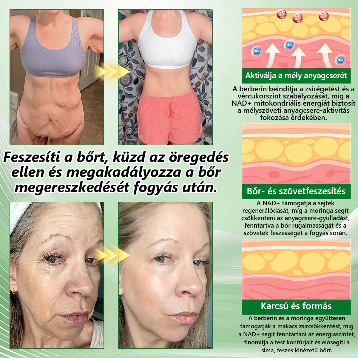 Hivatalos magyar üzlet | 👩‍⚕️🌲 PZGONE® Moringa · Berberin × NAD+ 10 az 1-ben fejlett nano-mikrotűs tapasz 🇭🇺 (Naponta csak egyszer) ✅ Elhízás, megereszkedett bőr, alacsony energiaszint, alvási apnoé, ízületi problémák és egyebek kezelésére